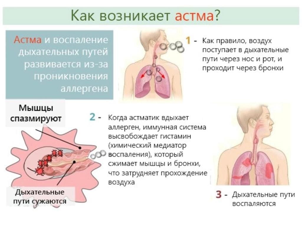 Тяжело дышать без кашля. Причины заболевания бронхиальной астмой. Бронхиальная астма причины. Из за чего возникает астма. Бронхиальная астма симптомы.